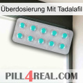 Überdosierung Mit Tadalafil 28